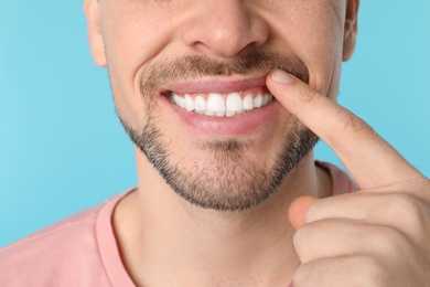 Smiling man showing perfect teeth on color background, closeup