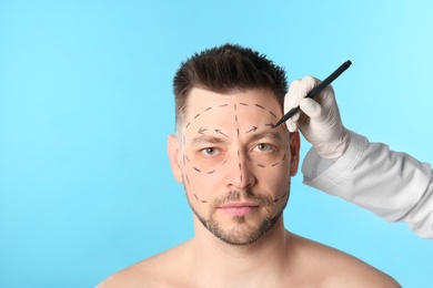 Doctor drawing marks on man's face for cosmetic surgery operation against blue background