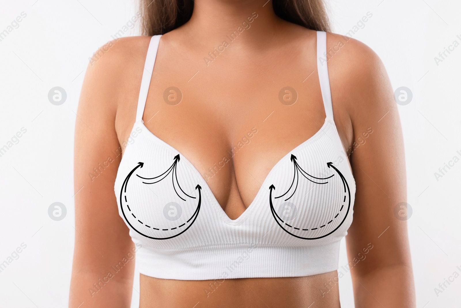 Image of Breast surgery. Woman with markings on bra against white background, closeup