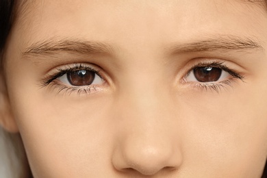 Photo of Little girl, closeup of eyes. Visiting ophthalmologist