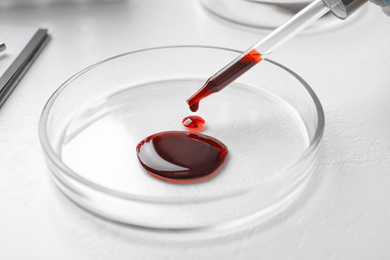 Image of Dripping blood from pipette into Petri dish on table, closeup. Laboratory analysis