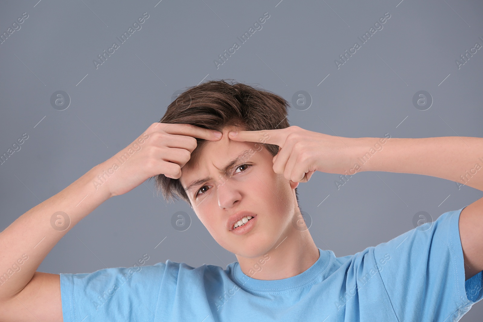 Photo of Teenage boy with acne problem on grey background