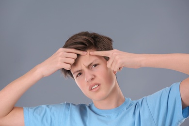 Teenage boy with acne problem on grey background