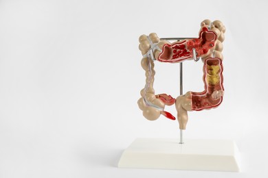 Photo of Human colon model on light background. Space for text
