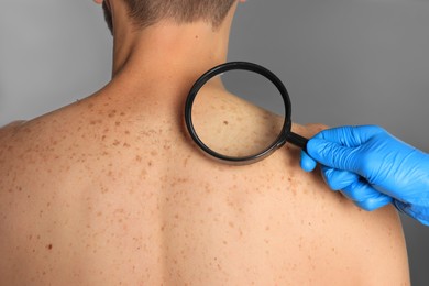 Dermatologist examining patient's birthmark with magnifying glass on grey background, closeup