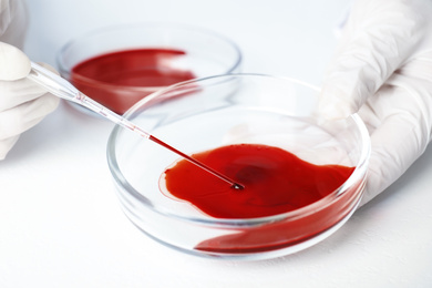Photo of Scientist taking blood sample from Petri dish with pipette in laboratory, closeup. Virus research