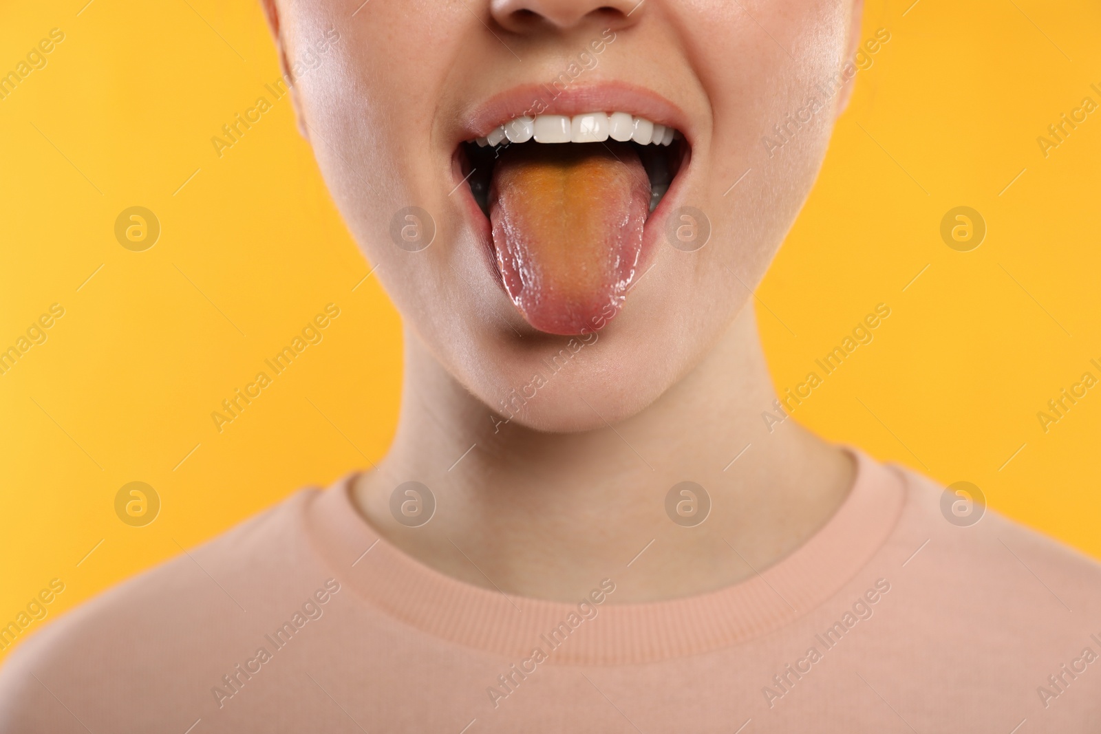 Photo of Gastrointestinal diseases. Woman showing her yellow tongue on color background, closeup