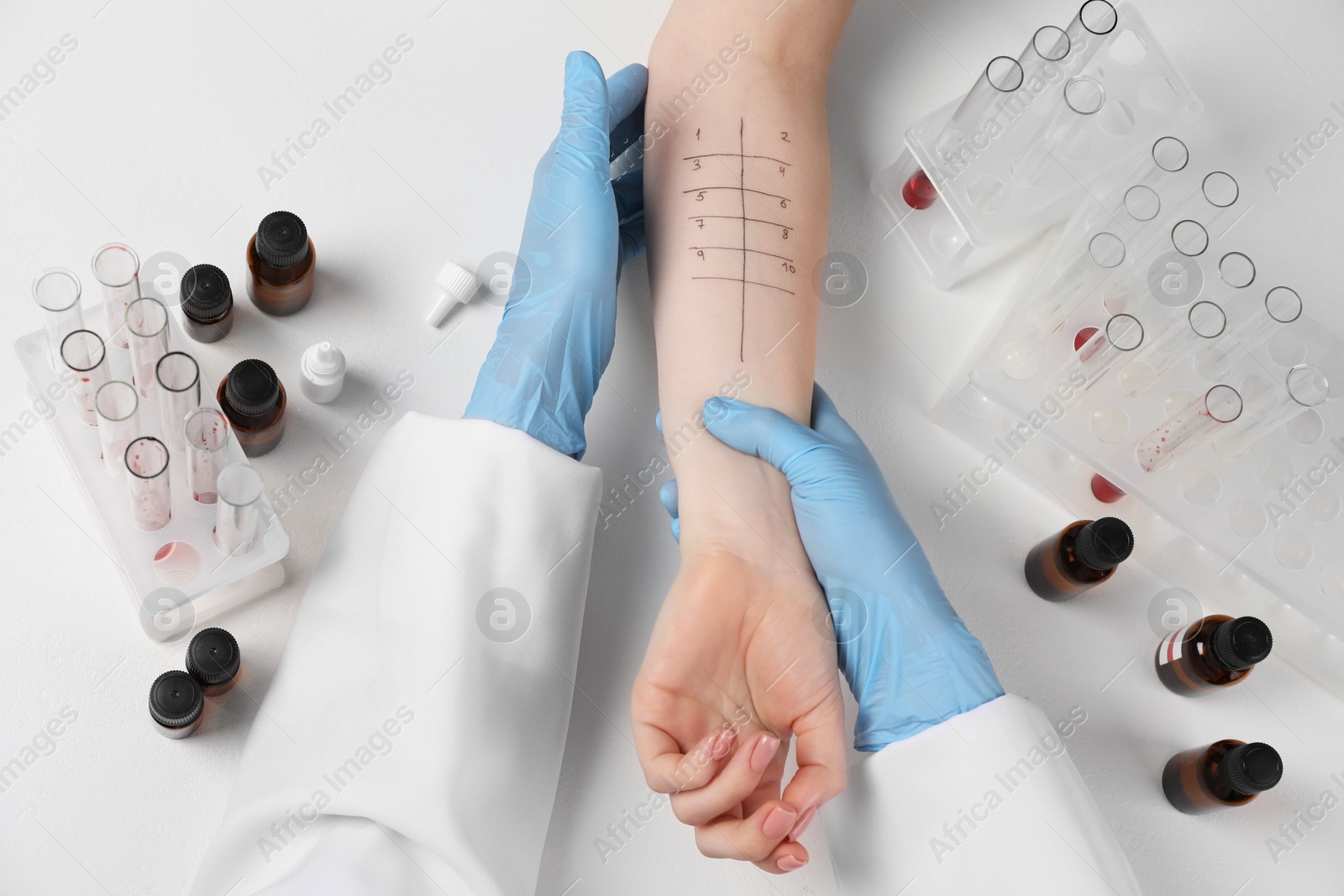 Photo of Doctor doing skin allergy test at light table, top view