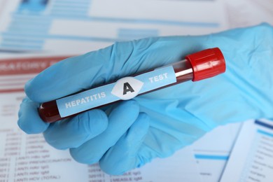 Photo of Scientist holding tube with blood sample and label Hepatitis A Test against laboratory forms, closeup