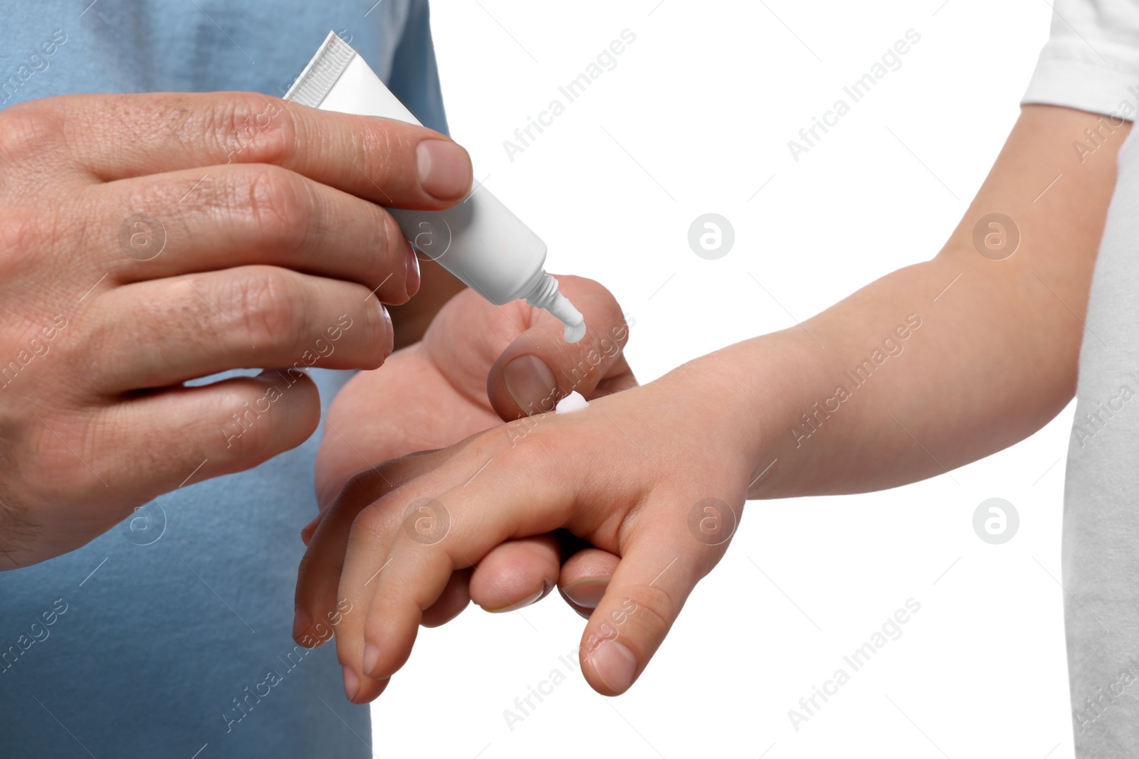 Photo of Father applying ointment onto his daughter's hand against white background, closeup