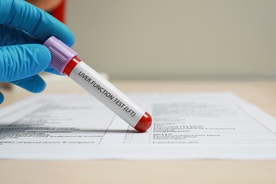 Photo of Liver Function Test. Laboratory worker with tube of blood sample and form at table, closeup