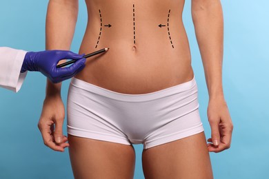 Woman preparing for cosmetic surgery, light blue background. Doctor drawing markings on her abdomen, closeup