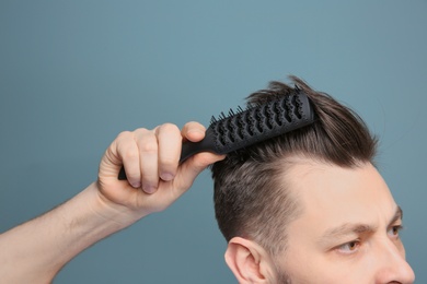 Photo of Young man with hair loss problem on color background