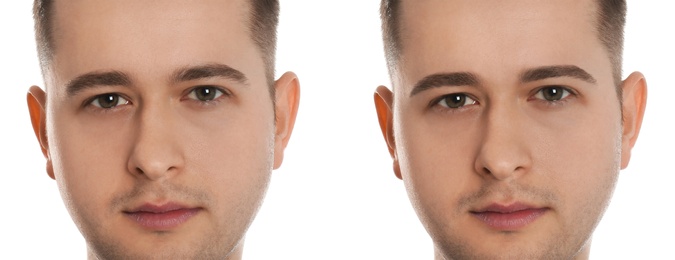 Image of Man before and after eyebrow modeling on white background, collage. Banner design