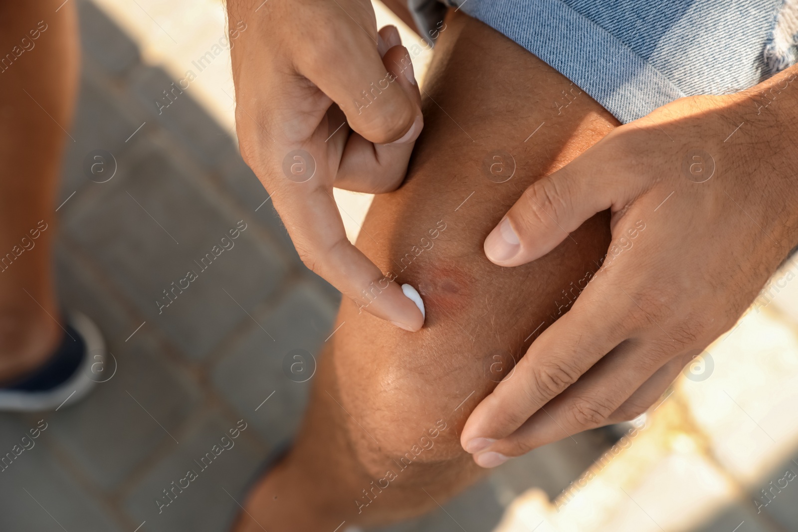 Photo of Man applying insect repellent cream on his leg outdoors, closeup