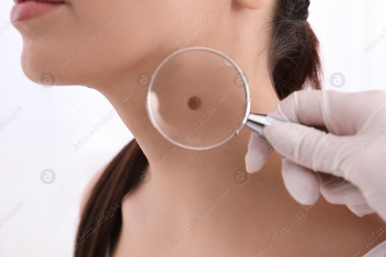 Photo of Dermatologist examining patient with magnifying glass in clinic, closeup view