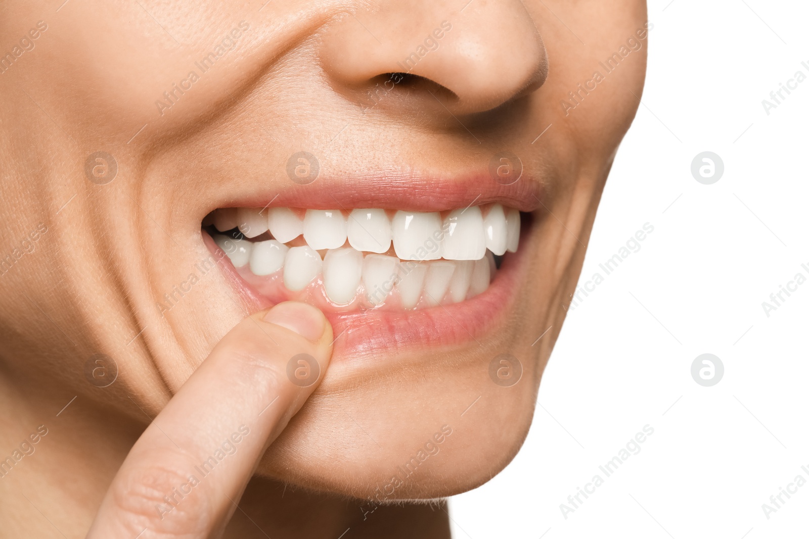 Photo of Woman showing healthy gums on white background, closeup