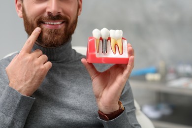 Man holding educational model of dental implant on blurred background, closeup. Space for text