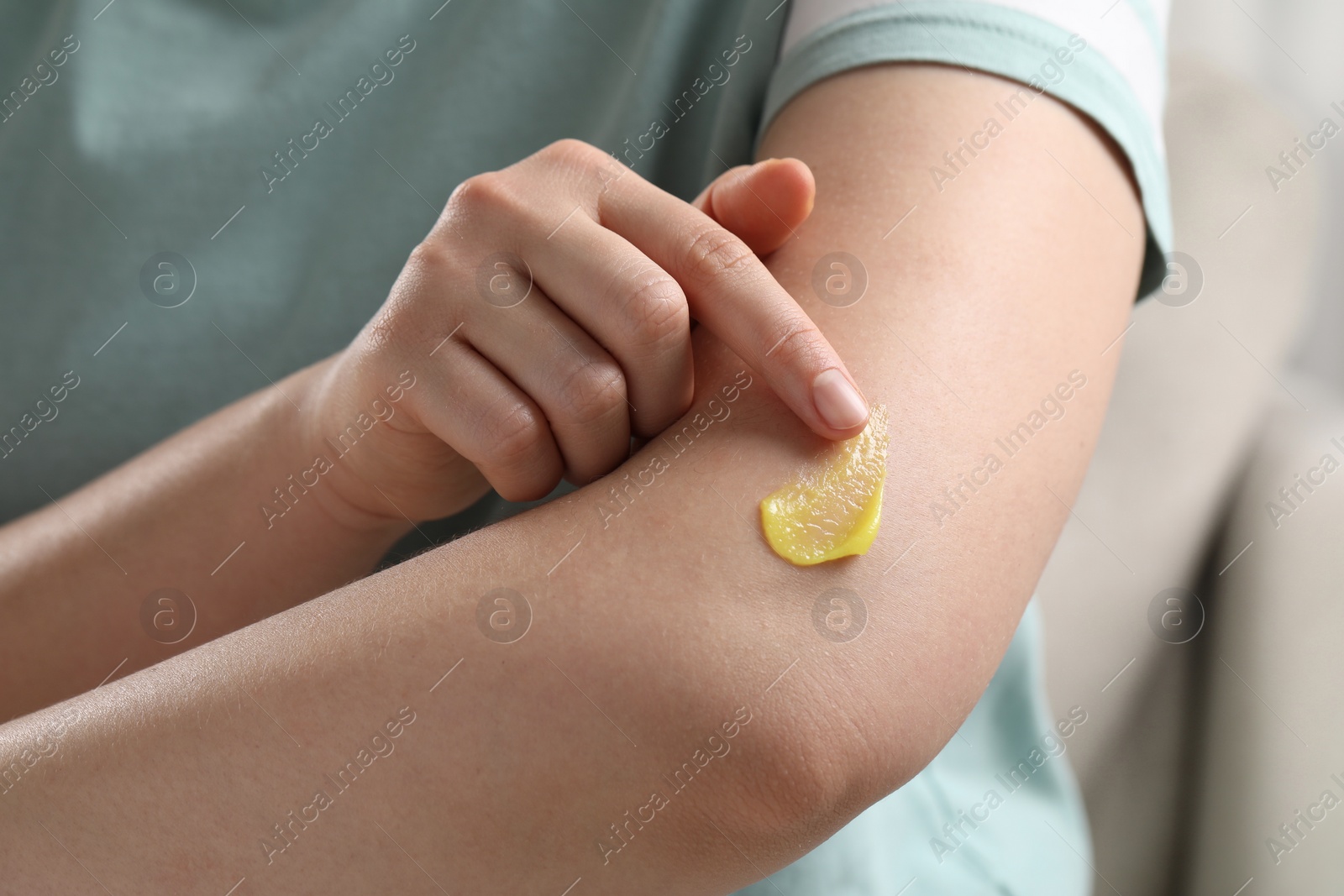 Photo of Woman applying ointment onto her arm indoors, closeup