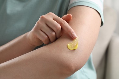 Photo of Woman applying ointment onto her arm indoors, closeup