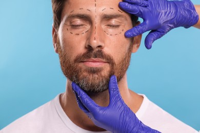 Doctor checking marks on man's face for cosmetic surgery operation against light blue background