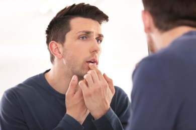 Photo of Young man applying cold sore cream on lips in front of mirror