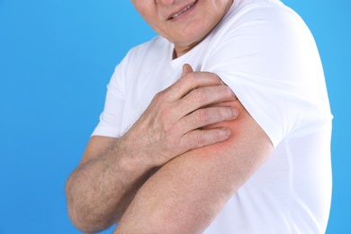 Senior man scratching arm on color background, closeup. Allergy symptom