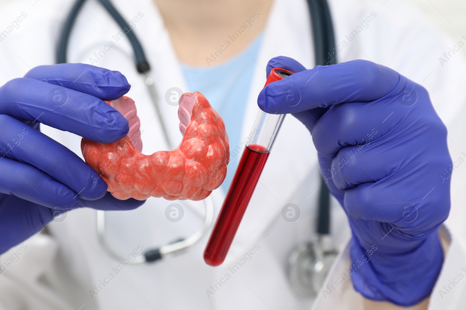 Photo of Endocrinologist showing thyroid gland model and blood sample in test tube, closeup