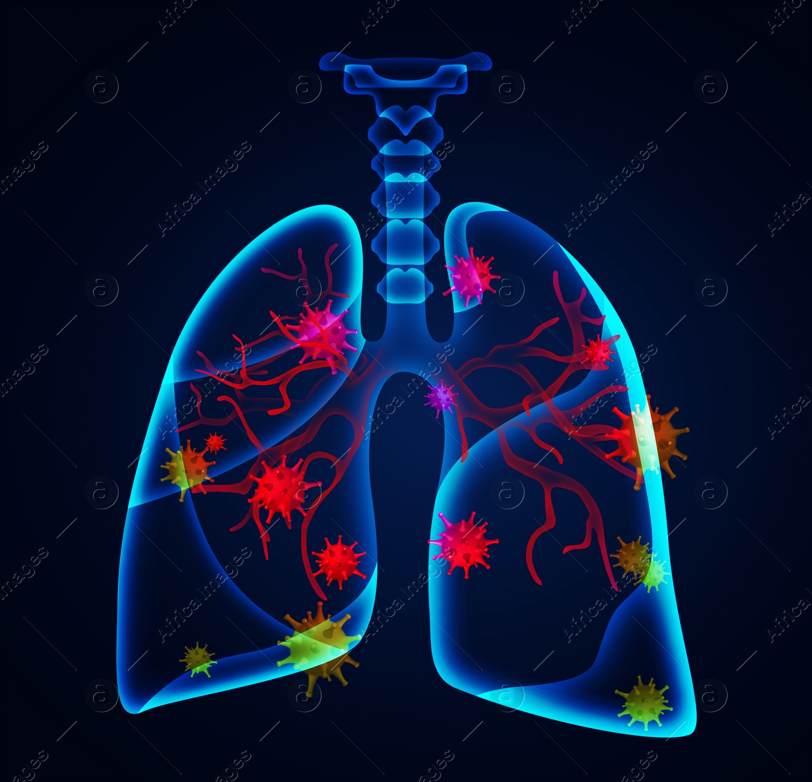 Illustration of  human lungs affected with disease on dark background