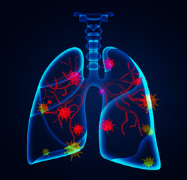 Illustration of  human lungs affected with disease on dark background