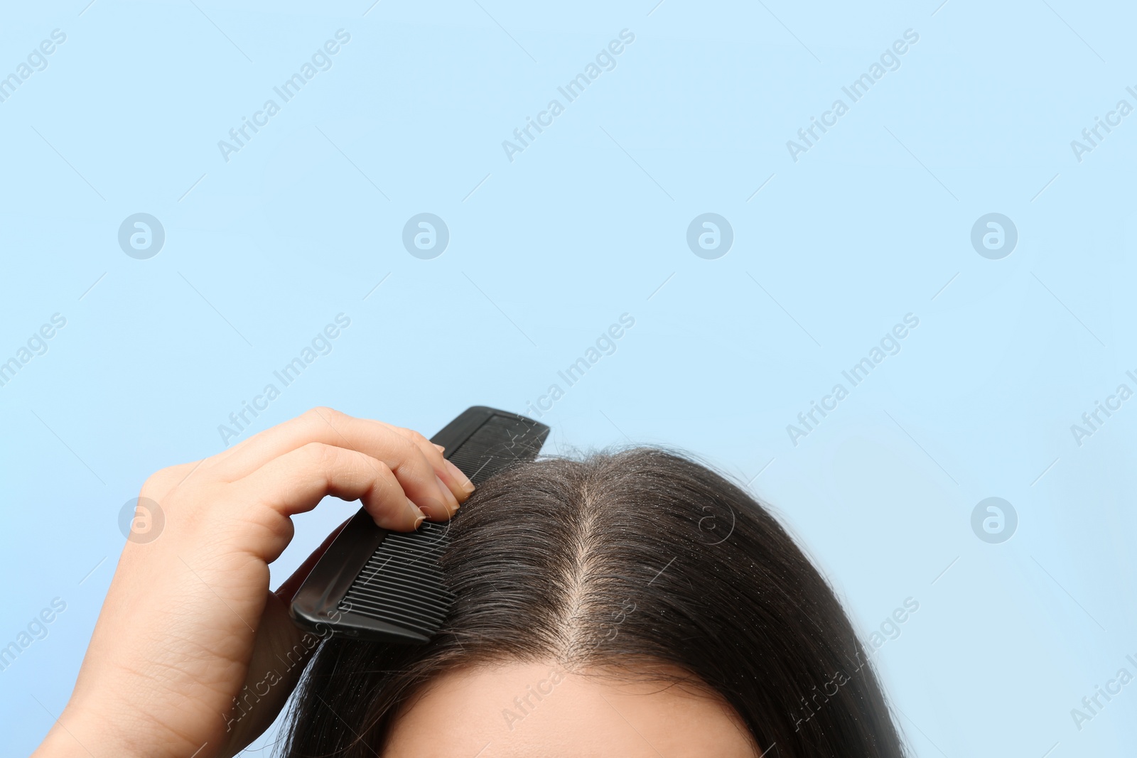 Photo of Woman with comb and dandruff in her dark hair on color background, closeup. Space for text