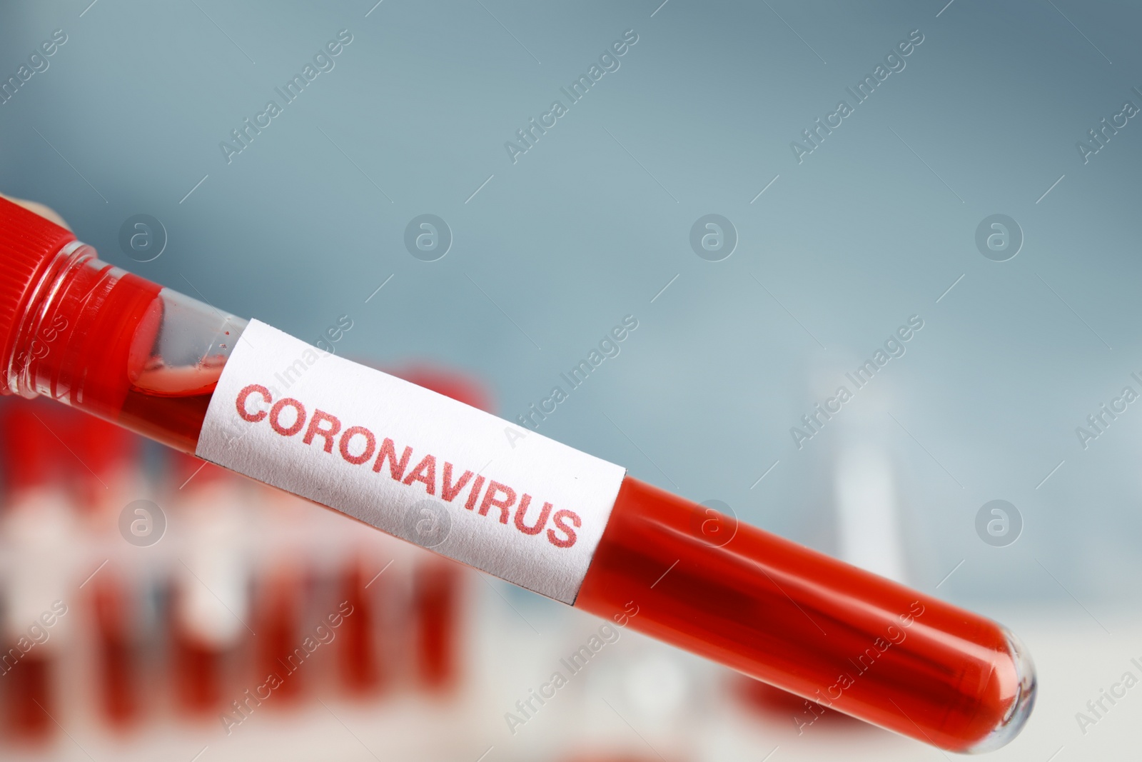 Photo of Test tube with blood sample and label CORONA VIRUS in laboratory, closeup