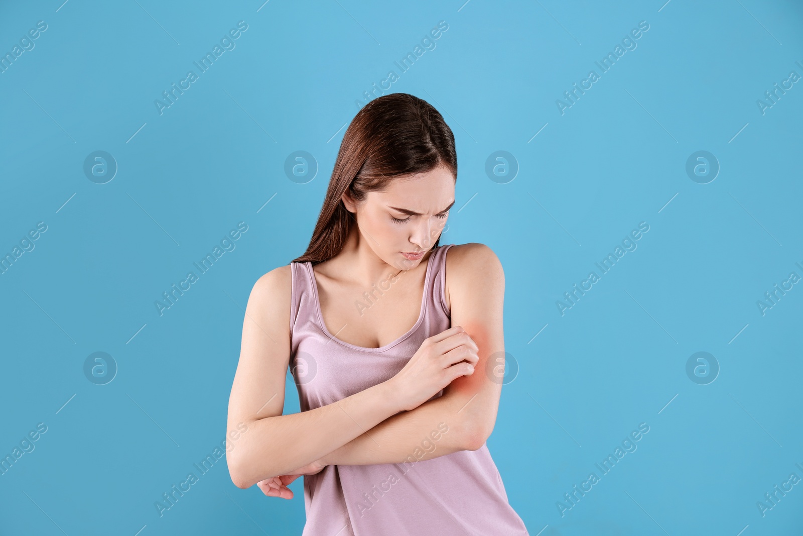 Photo of Young woman scratching hand on color background. Allergies symptoms