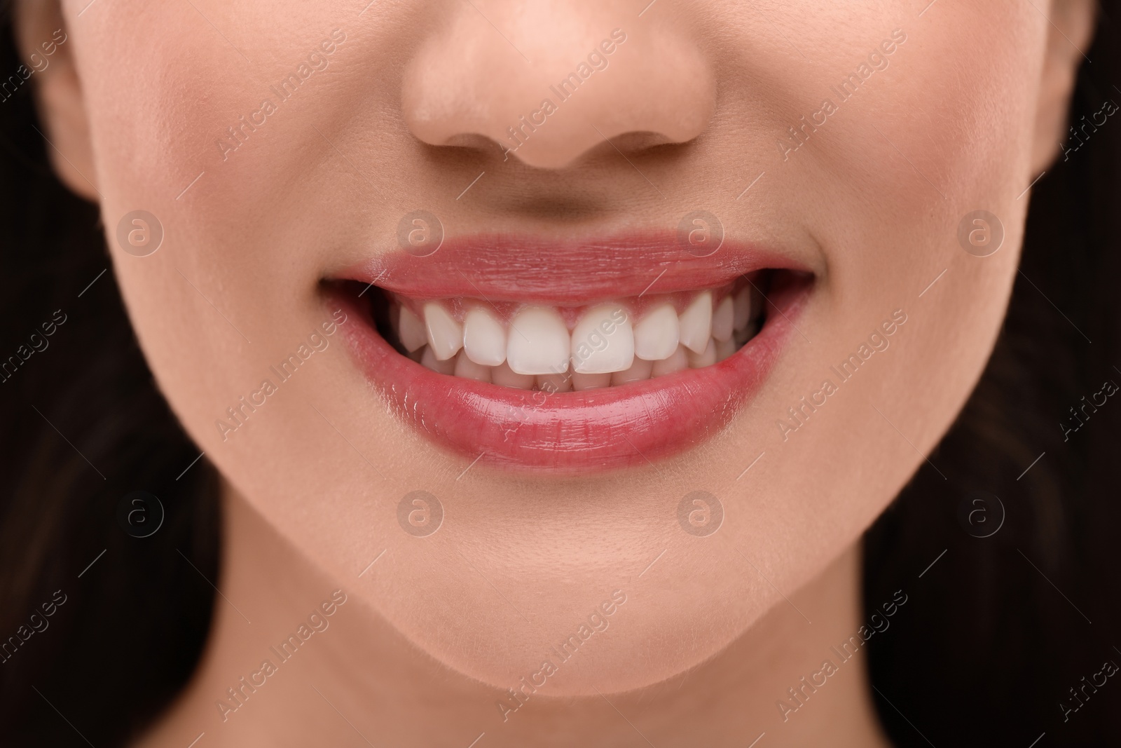 Photo of Woman with clean teeth smiling, closeup view