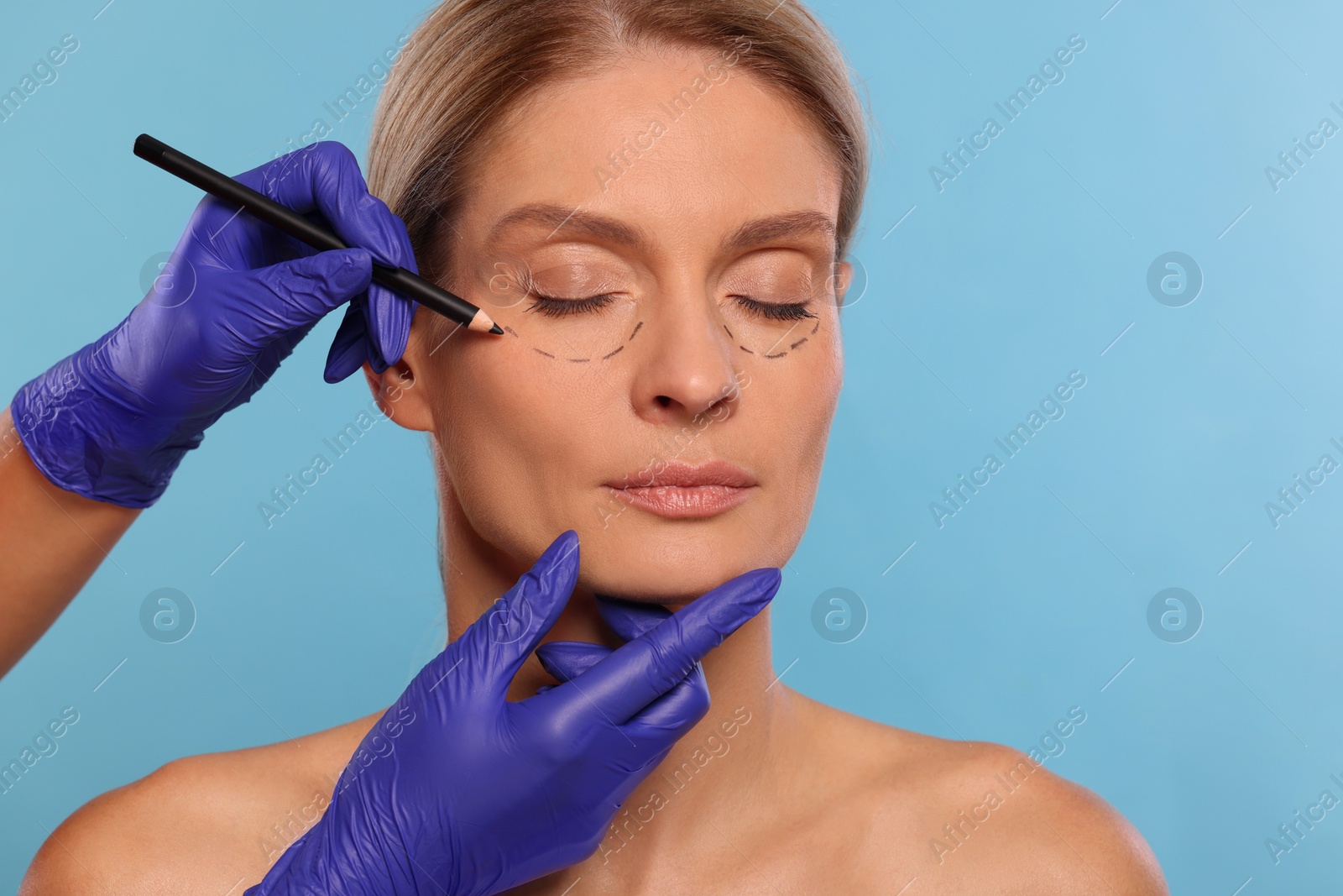 Photo of Doctor with pencil preparing patient for cosmetic surgery operation on light blue background, closeup