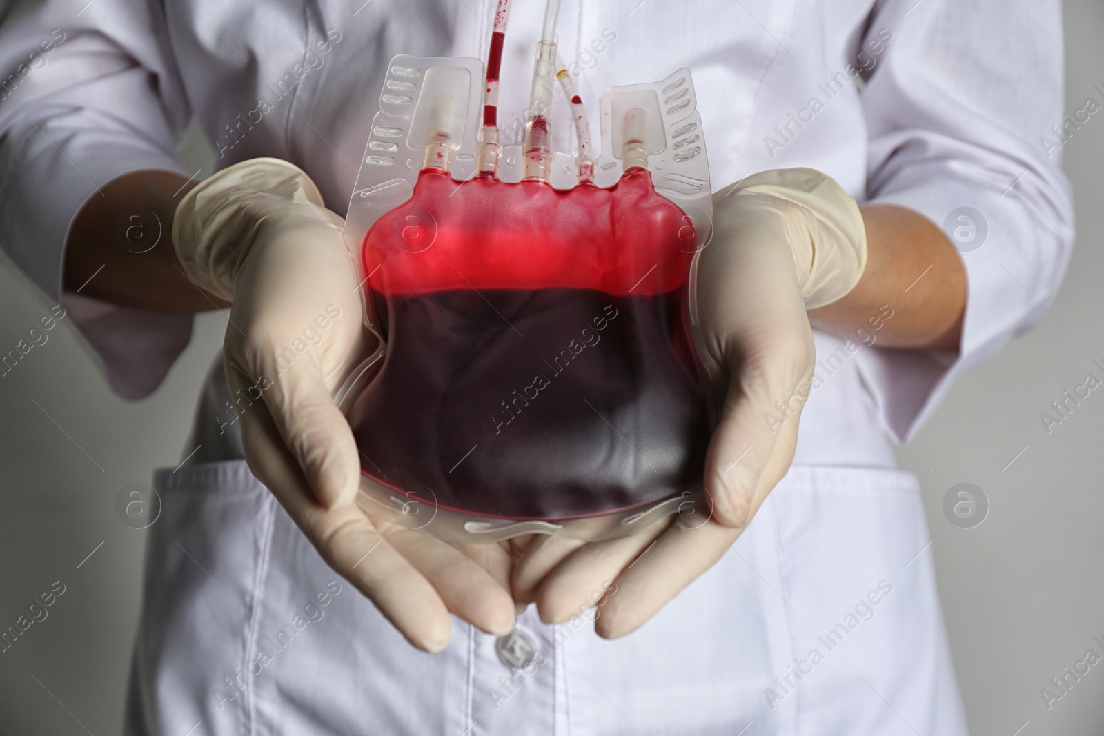 Photo of Woman holding blood for transfusion on light grey background, closeup. Donation concept