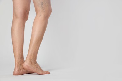 Photo of Closeup view of woman with varicose veins on light background. Space for text