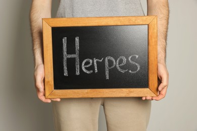 Photo of Man holding small chalkboard with word Herpes on beige background, closeup