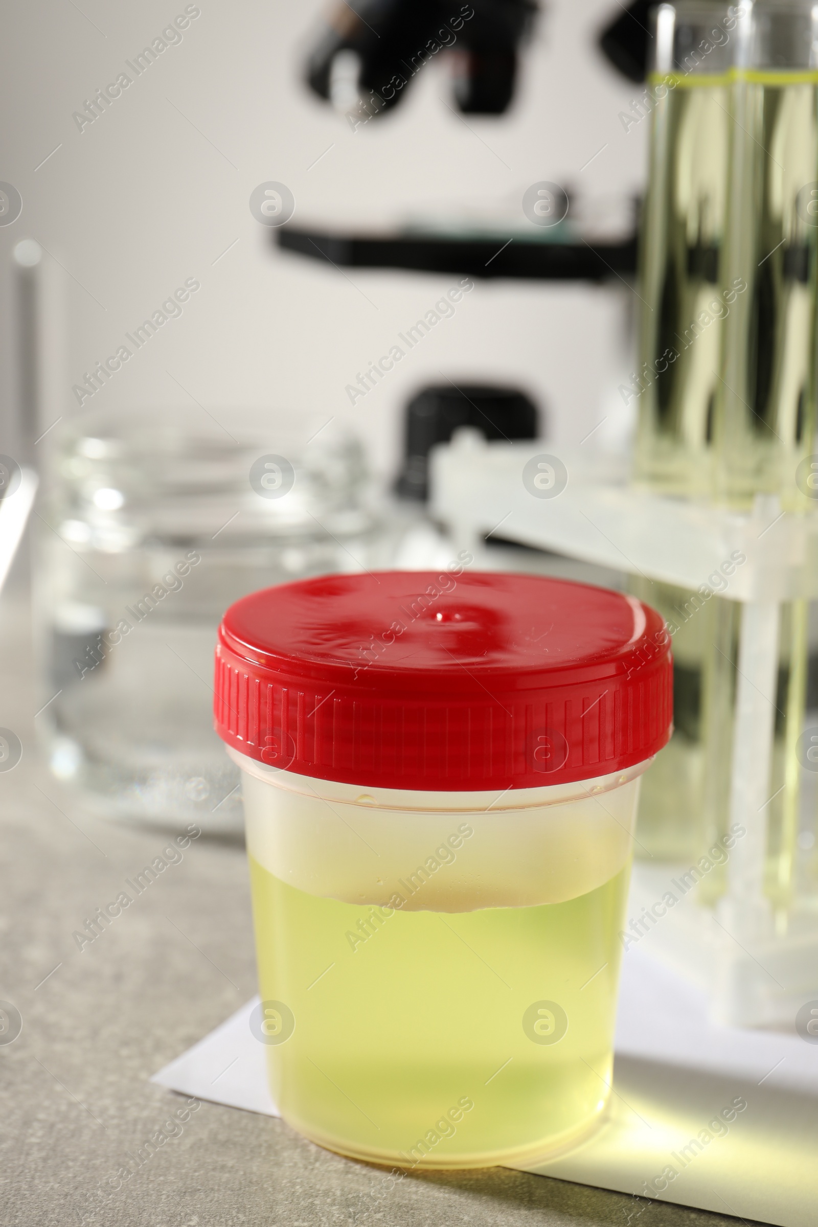 Photo of Container with urine sample for analysis and glassware on grey table indoors
