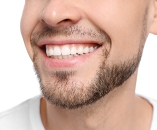 Young man with beautiful smile on white background. Teeth whitening