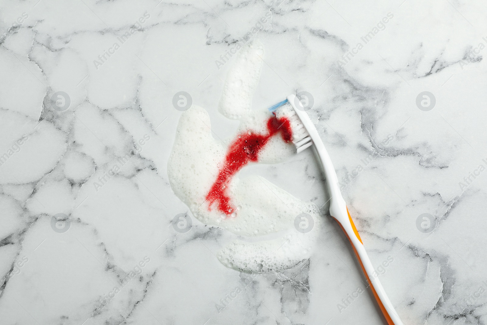 Photo of Brush and toothpaste foam with blood on white marble table, top view. Gum problems