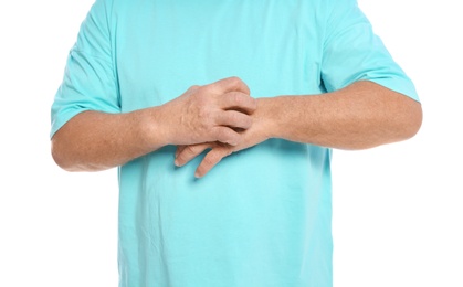 Photo of Mature man scratching arm on white background, closeup. Annoying itch