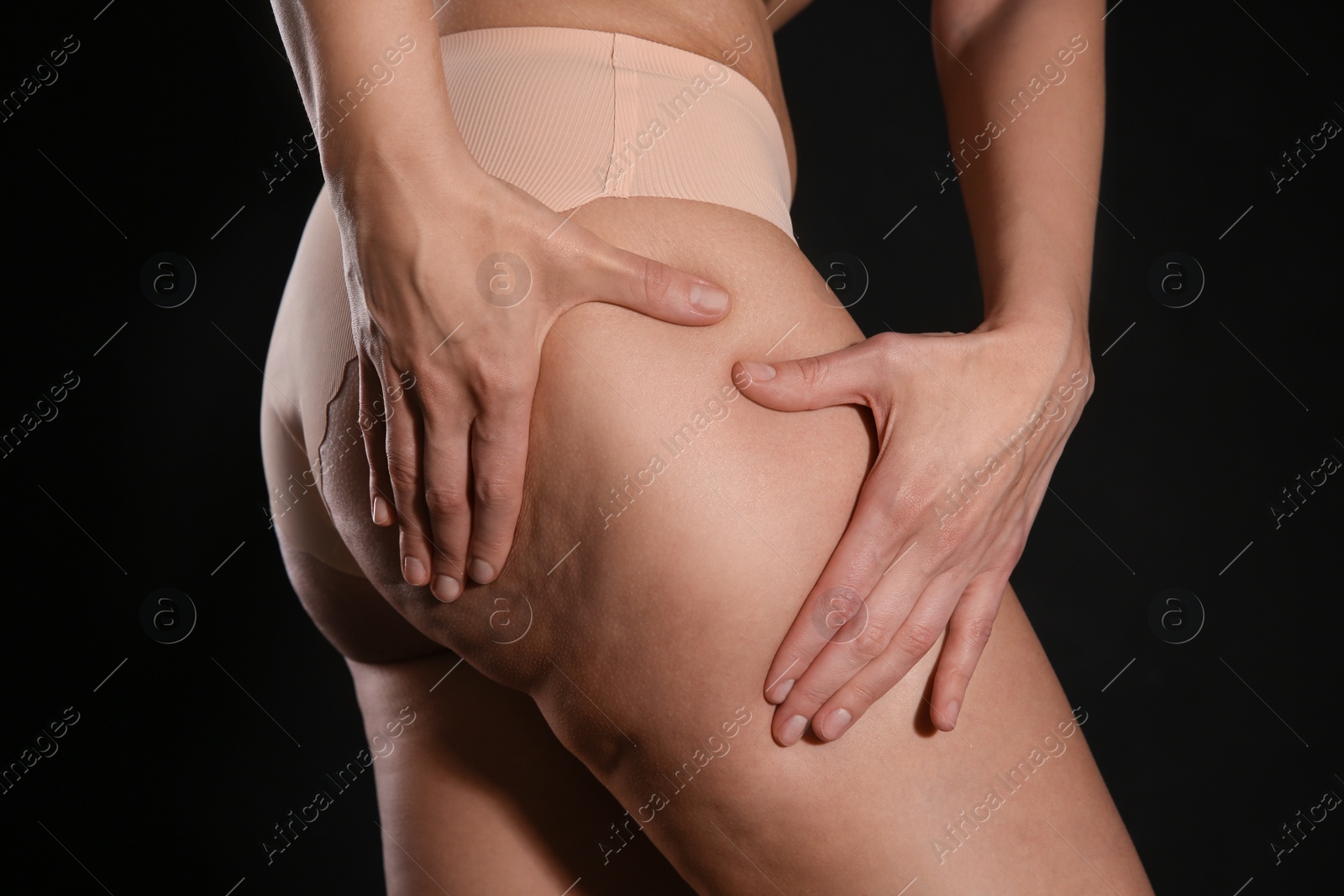 Photo of Woman with cellulite on black background, closeup