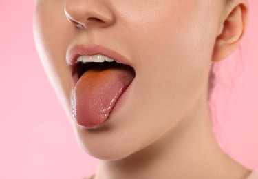 Gastrointestinal diseases. Woman showing her yellow tongue on pink background, closeup