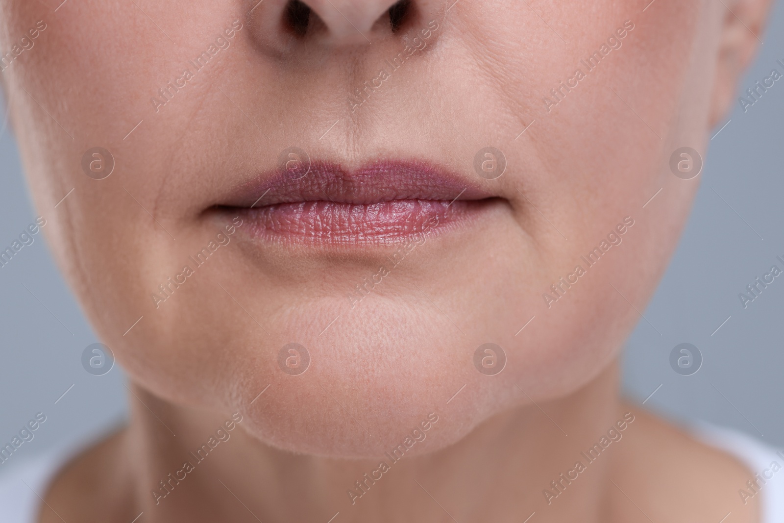 Photo of Senior woman with aging skin on grey background, closeup. Rejuvenation treatment