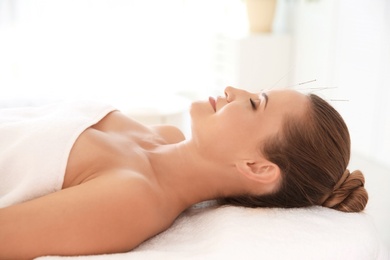 Photo of Young woman undergoing acupuncture treatment in salon