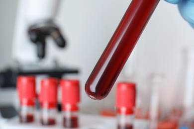 Scientist holding test tube with blood sample, closeup. Laboratory analysis