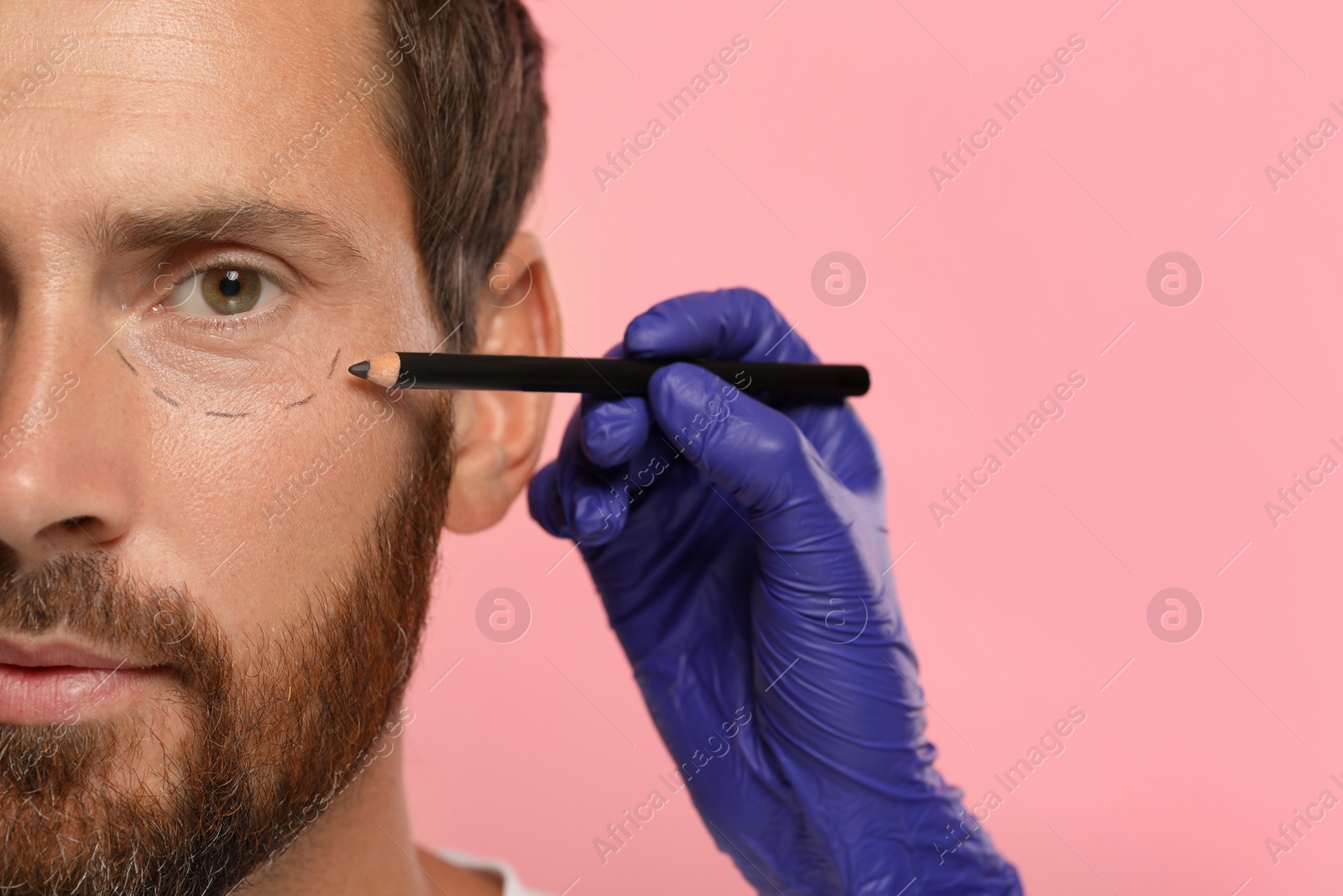 Photo of Doctor with pencil preparing patient for cosmetic surgery operation on pink background, closeup. Space for text