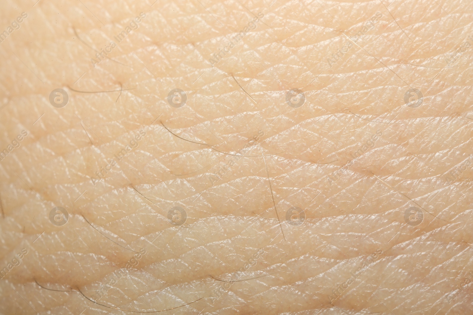 Photo of Texture of dry skin as background, macro view