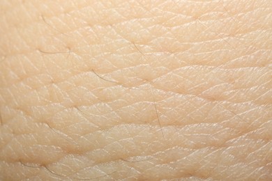 Photo of Texture of dry skin as background, macro view